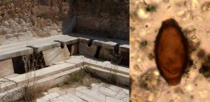A sinistra: latrine romane da Leptis Magna in Libia, Credit: Craig Taylor. A destra: uova di verme a frusta di epoca romana dalla Turchia, Credit: Piers Mitchell