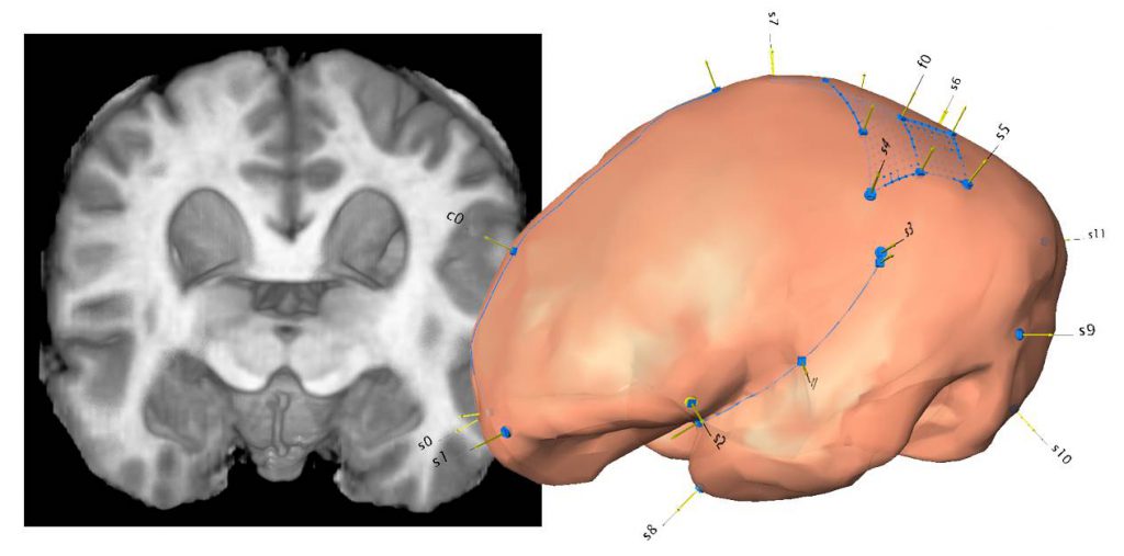 brain fossils neuroanatomy