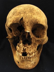 Teschio dello scheletro T15, un maschio tra i 35 e i 50 anni, seppellito in un cimitero nei pressi di Casal Bertone, Roma. Le analisi suggeriscono possa essere nato vicino le Alpi. Credit: Kristina Killgrove