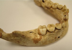 Denti da latte di epoca medievale. Credit: University of Kent