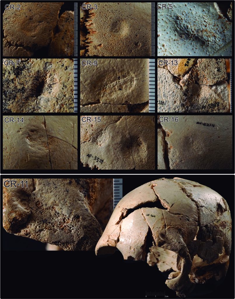 Análisis tafonómico-forense cráneos Sima de los Huesos taphonomic-forensic analysis