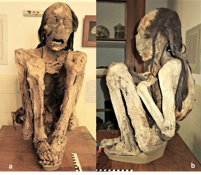 South American mummies were murdered