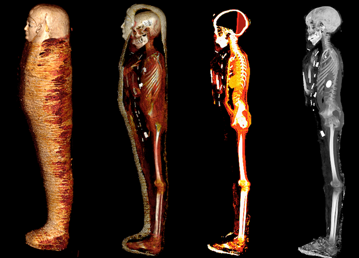 ‘Golden boy’ mummy was protected by 49 precious amulets, CT scans reveal