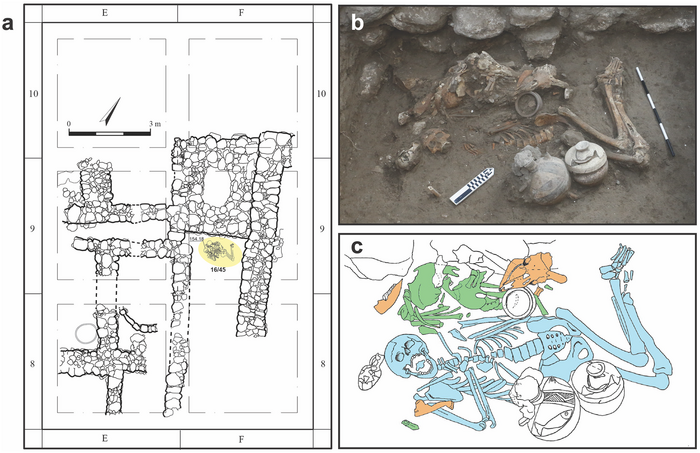 brothers brain surgery Bronze Age Israel