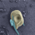 Didascalia: foto al microscopio elettronico (SEM) di un granulo di amido (colorato in giallo) associato a dei cristalli di ossalato chiamati rafidi (colorato in azzurro)