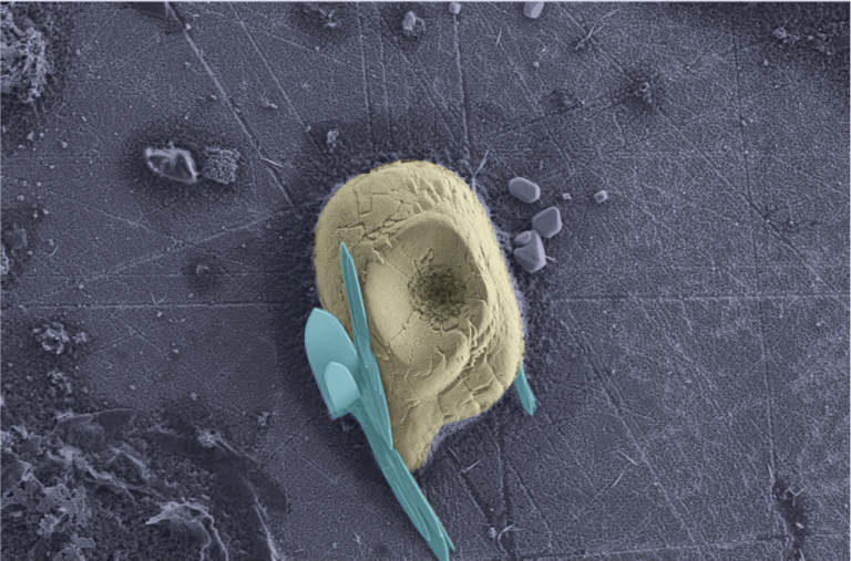 Didascalia: foto al microscopio elettronico (SEM) di un granulo di amido (colorato in giallo) associato a dei cristalli di ossalato chiamati rafidi (colorato in azzurro)
