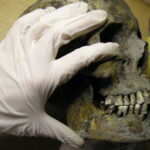 Vikings in Varnhem, Sweden, suffered from tooth decay
