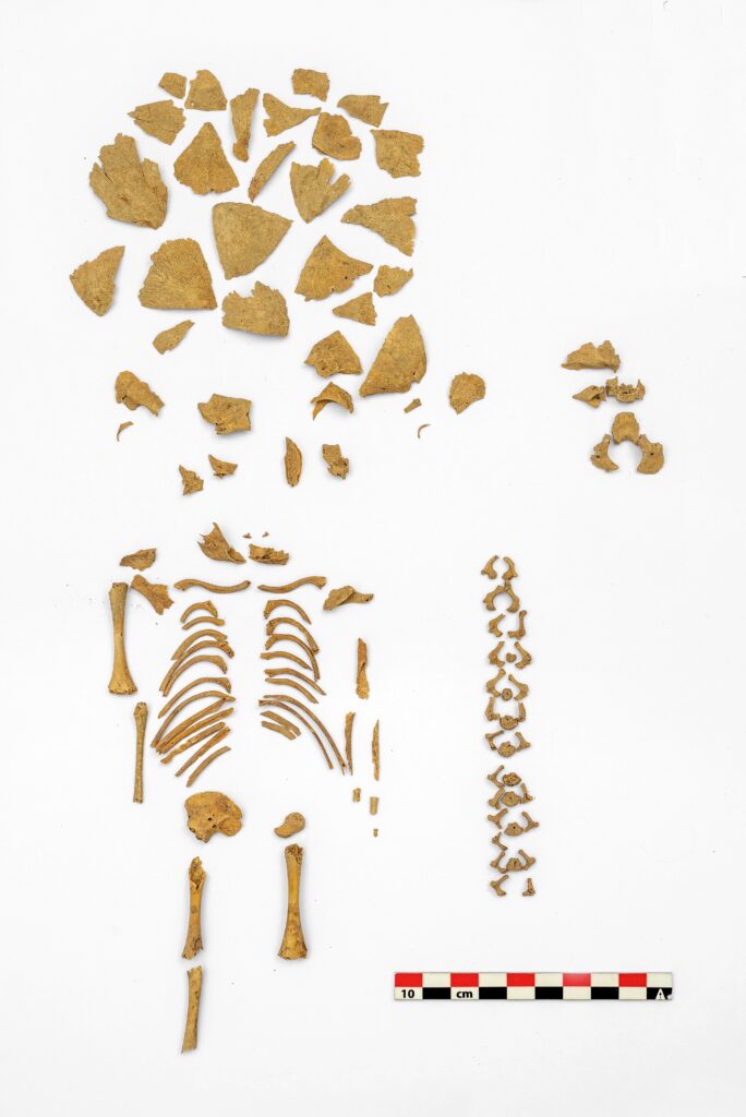 ADN antiguo síndrome de Down edad del hierro península Ibérica Down Syndrome Iberian Peninsula's Iron Age Skeleton of a baby boy with Down Syndrome in Las Eretas, Navarre, who died approximately with a gestational age of 26 weeks. (© Foto J.L. Larrión, Gobierno de Navarra)