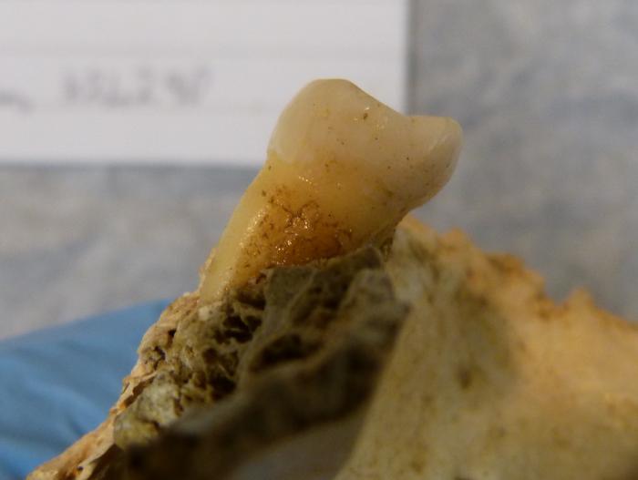 An EXAMPLE of a tooth prior to ancient DNA sampling. Note this was not the tooth sampled in the study. Credits: Dr Lara Cassidy, Trinity