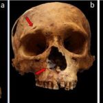 Various traumatic injuries in one of the individuals studied: a) perimortem penetrating fracture in right parietal produced by blunt force trauma; b) cut mark in right superciliary arch relating to sharp force trauma, and perimortem injury relating to stone flake, which remains embedded in right wall of nasal pyriform aperture; c) healed linear penetrating fracture and cut marks in left zygomatic bone relating to sharp-blunt force trauma, and healed nasal fracture. Credits: Luis Pezo-Lanfranco
