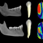 caninos estimación del sexo Main differences in dentin morphology of permanent canines of males and females from current populations/C. García Campos