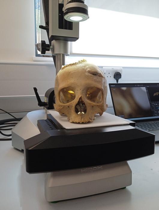 The skulls were examined using microscopic analysis and CT scanning. Image Credits: Tondini, Isidro, Camarós, 2024