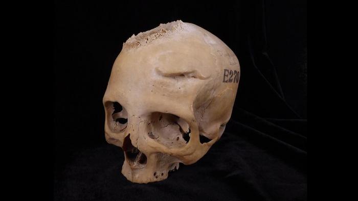 Skull E270, dating from between 663 and 343 BCE, belonged to a female individual who was older than 50 years. Image Credits: Tondini, Isidro, Camarós, 2024