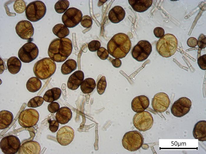 Fungus culture: conidia of Alternaria sp. NS1. Credits: Laura Rabbachin, INTK, Academy of Fine Arts, Vienna