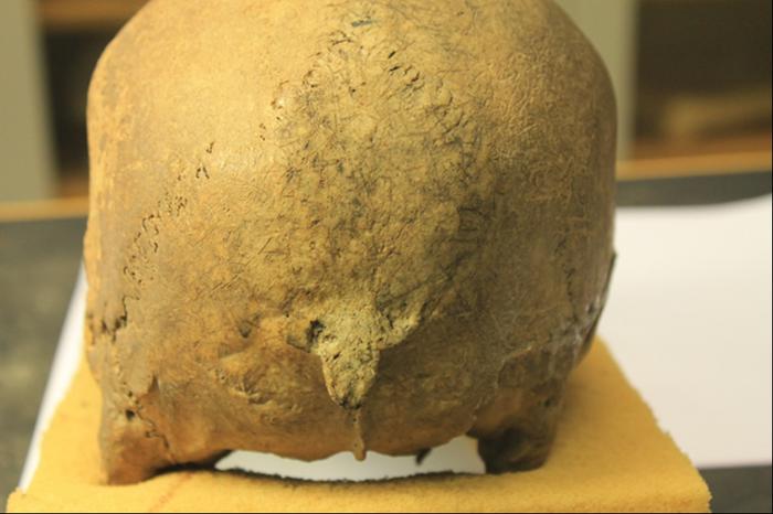 From the Viking skeletal study: Antemortem damage is observable with remodeling of the occipital bone. Credits: Lisa Mariann Strand