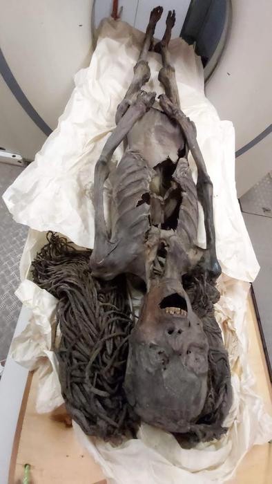 The Screaming Woman in the CT scan. Credits: Sahar Saleem, CC BY