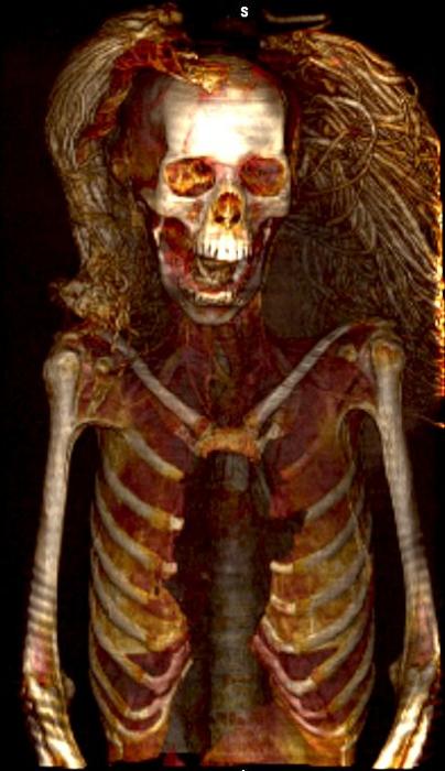 The Screaming Woman mummy, wearing her wig. Credits: Sahar Saleem, CC BY