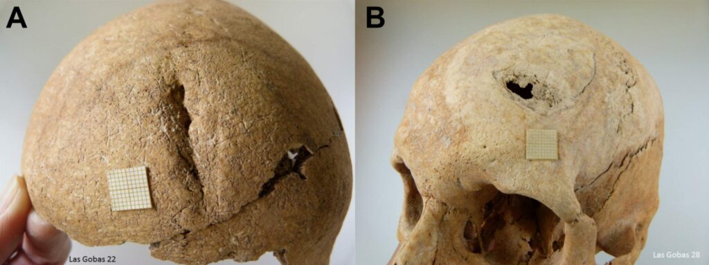Skulls showing signs of violence. / Lourdes Herrasti