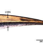 muerte de los bebés íberos Neonatal line of a baby’s central incisor from the Olèrdola (Alt Penedès) site. Credit: Biological Anthropology Unit, UAB