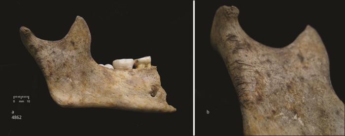 Right hemi-mandible of child aged about 10 years (a) with detail of cutmarks on the ascending ramus (b). Image credit: Schulting et al. Antiquity, December 2024
