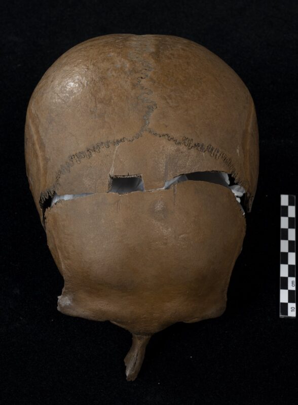 Parts of a face and the left side of the skeleton were not found. Photo: Åge Hojem, NTNU University Museum