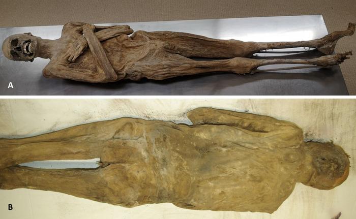 External appearance of the mummy from the ventral (A) and dorsal side (B) showing a completely intact body wall. Credit: Andreas Nerlich