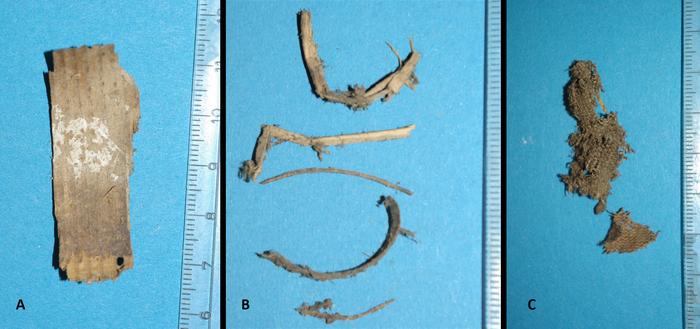 Analysis of the packing material obtained during the partial autopsy of the abdomen revelaed A: Typical wood chip. B: Twigs of various plants. C: Small fragment of a simple fabric made of hemp or flax. Image: Andreas Nerlich