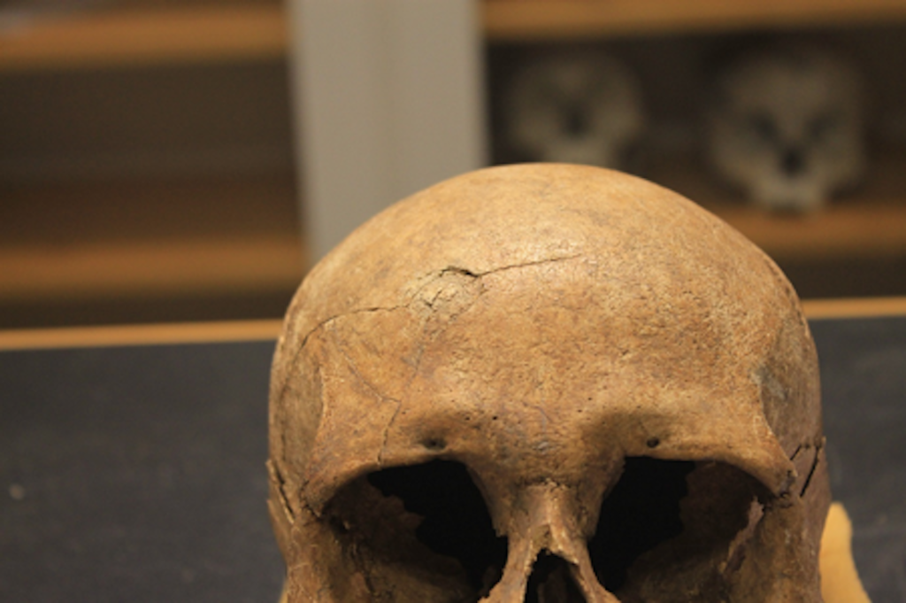 This skull of a female from a burial mound in what is now Ringsaker shows evidence of a blunt force injury that happened just prior to or during the woman's death. The blow caused a semi-circular depression in the skull with radiating lines. Photo: Lisa Mariann Strand