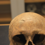 This skull of a female from a burial mound in what is now Ringsaker shows evidence of a blunt force injury that happened just prior to or during the woman's death. The blow caused a semi-circular depression in the skull with radiating lines. Photo: Lisa Mariann Strand