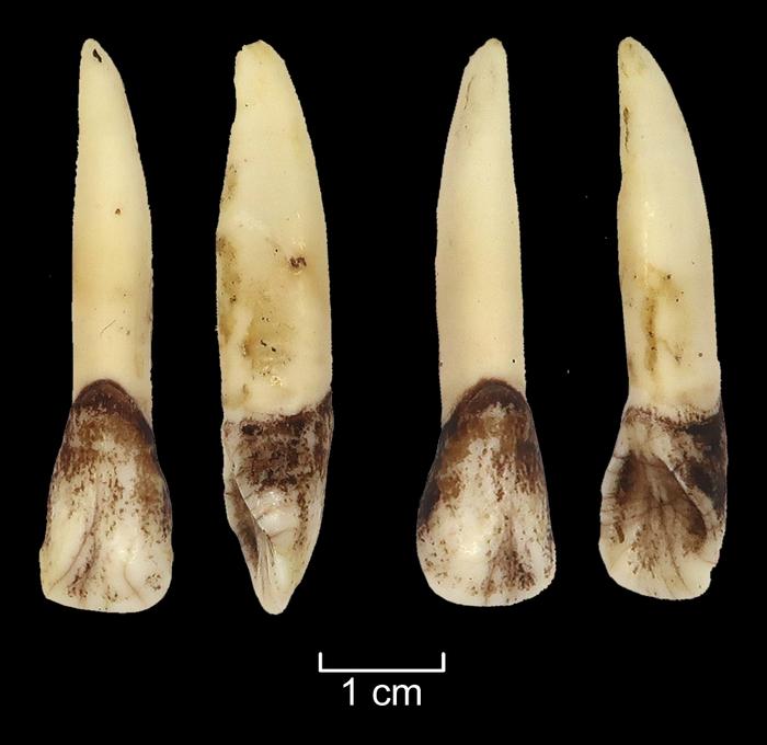 The most effective methods were found to be soaking, boiling and cooking in a pit, which extracted the teeth with minimal or no damage. The image shows incisors of the Eurasian elk extracted by soaking. Photo Credits: Aija Macāne