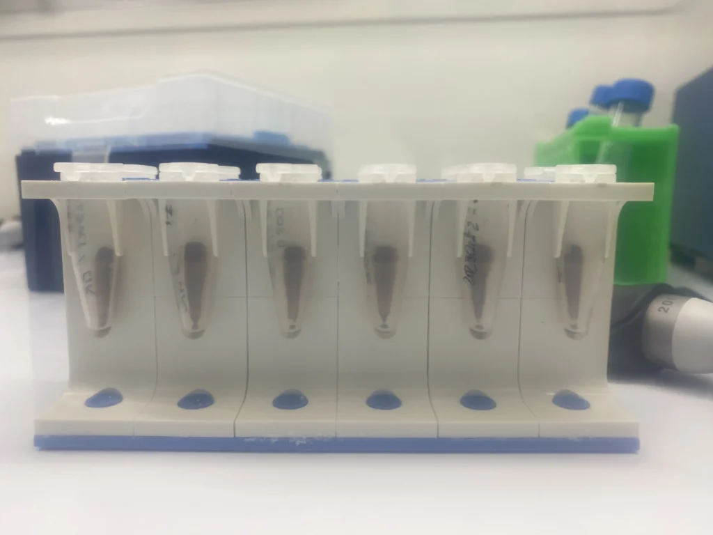 Perle biomagnetiche sono usate per isolare le proteine dai campioni di tartaro dentario proveniente da resti in siti archeologici. I campioni che mostrano buona conservazione di proteine assumono una forma triangolare, come mostrato nell’immagine (foto GR)