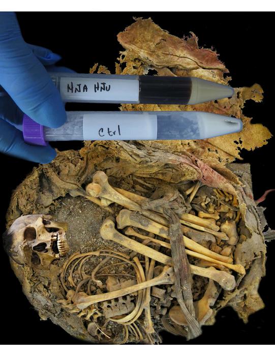 Zimapán man, also referred to as Hna Hnu, was a resident of the Mesoamerican border who lived 1,000 years ago. The image shows the moment when Hna Hnu's body was opened. This body was found inside a cave in a dry environment, which allowed their remains to remain for nearly 1,000 years. From the remains, we were able to isolate a coprolite and intestinal tissue, which was used to extract the DNA of the bacteria still present at the time of Hna Hnu’s life. From this genetic material, we were able to recover their gut microbiome community. Bacteria associated with the degradation of complex plant tissue and even, very likely, with the degradation of insect molecules such as those of the Clostridium genus were discovered. Hna Hnu provided us with valuable information about the association between the microbiome and diet. Photo Credits: Rene Cerritos Flores, CC-BY 4.0
